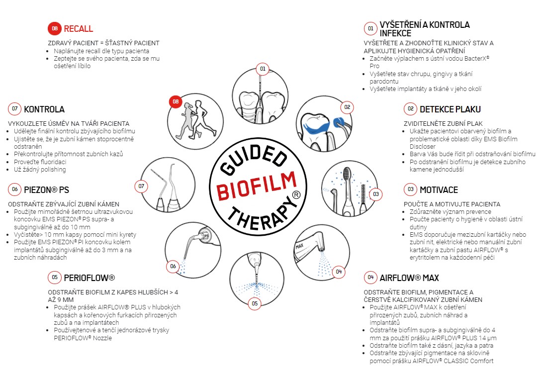 Guided Biofilm Therapy